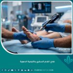علاج القدم السكري بأحدث التقنيات الطبية في مركز متطور للأوعية الدموية.