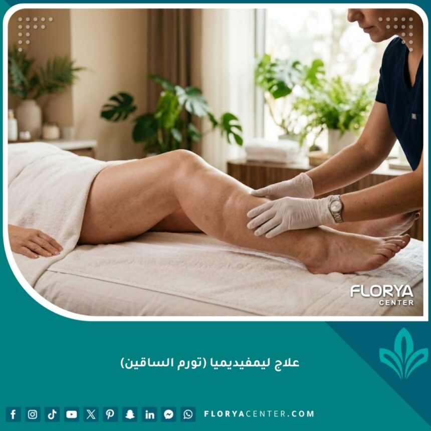 جلسة تدليك احترافي للتصريف اللمفاوي اليدوي لعلاج تورم الساقين النامج عن الليمفيديميا في مركز طبي متطور.
