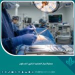 طبيب خبير يستعد لإجراء عملية إبراز العضو الذكري المدفون في غرفة عمليات حديثة.