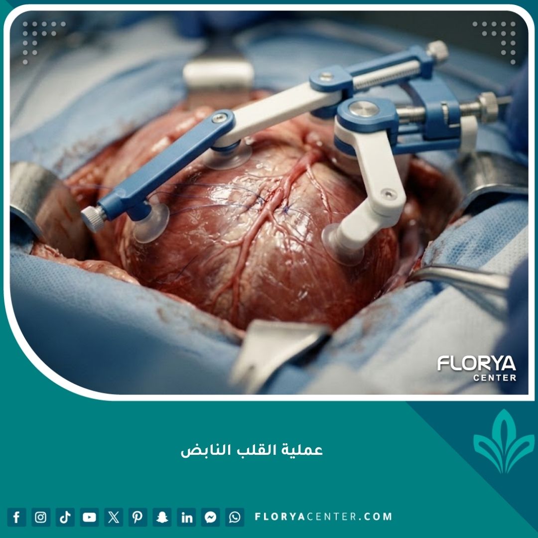 صورة سينمائية لعملية القلب النابض توضح دقة الجراحة المجهرية للشرايين التاجية.