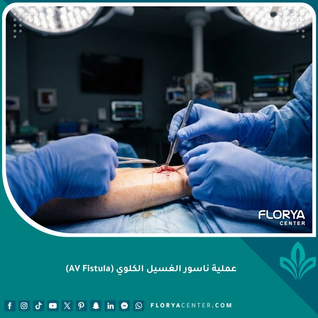 لقطة سينمائية لعملية ناسور الغسيل الكلوي (AV Fistula) داخل غرفة عمليات معقمة في مستشفى حديث.