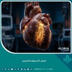 صورة واقعية سينمائية لقلب بشري تظهر ترسبات الكالسيوم في الشرايين التاجية لتقييم مخاطر النوبات القلبية.