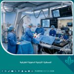 صورة مميزة لغرفة عمليات قسطرة الأوعية الدموية الطرفية الحديثة بأحدث التقنيات الطبية.