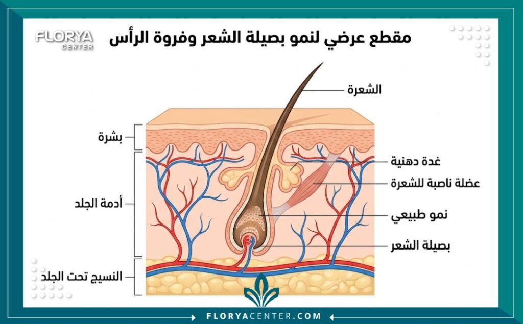 رسم تخطيطي تشريحي يوضح آلية انغراس بصيلة الشعر في الجلد بعد عملية الزراعة.