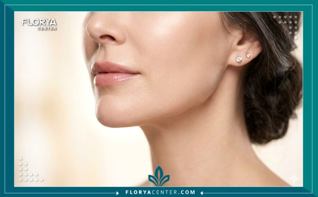 لقطة قريبة تبرز نعومة وشد البشرة حول الفم والفك بعد خضوع السيدة لتقشير الفينول العميق للتخلص من خطوط الحزن والتجاعيد.