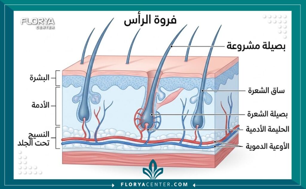 رسم توضيحي طبي يظهر تشريح فروة الرأس وكيفية تثبيت البصيلة المزروعة في الأنسجة.