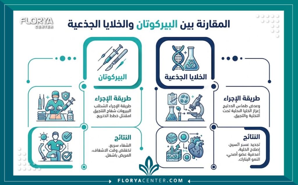 إنفوجرافيك مقارنة بين مميزات زراعة الشعر بتقنية البيركوتان وفوائد علاج تساقط الشعر بالخلايا الجذعية.