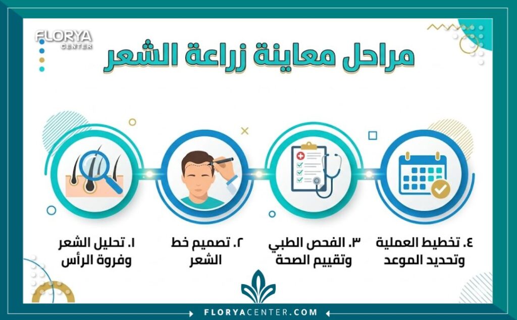 إنفوجرافيك يوضح الخطوات الأربع الرئيسية التي تتم خلال جلسة المعاينة لعملية زراعة الشعر.