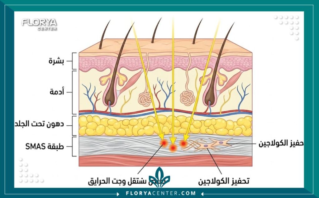 رسم تخطيطي طبي يوضح كيفية تأثير موجات الهايفو على طبقة SMAS العميقة لشد الجلد وإنتاج الكولاجين.