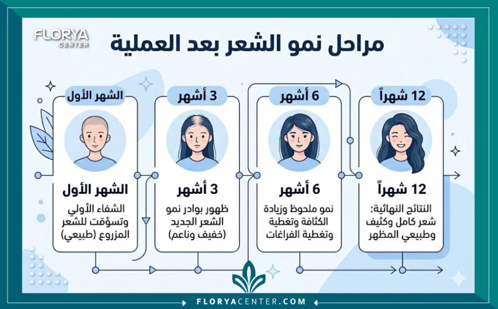 تجارب زراعة الشعر للنساء 3 إنفوجرافيك يوضح مراحل نمو الشعر والنتائج المتوقعة ضمن تجارب زراعة الشعر للنساء.