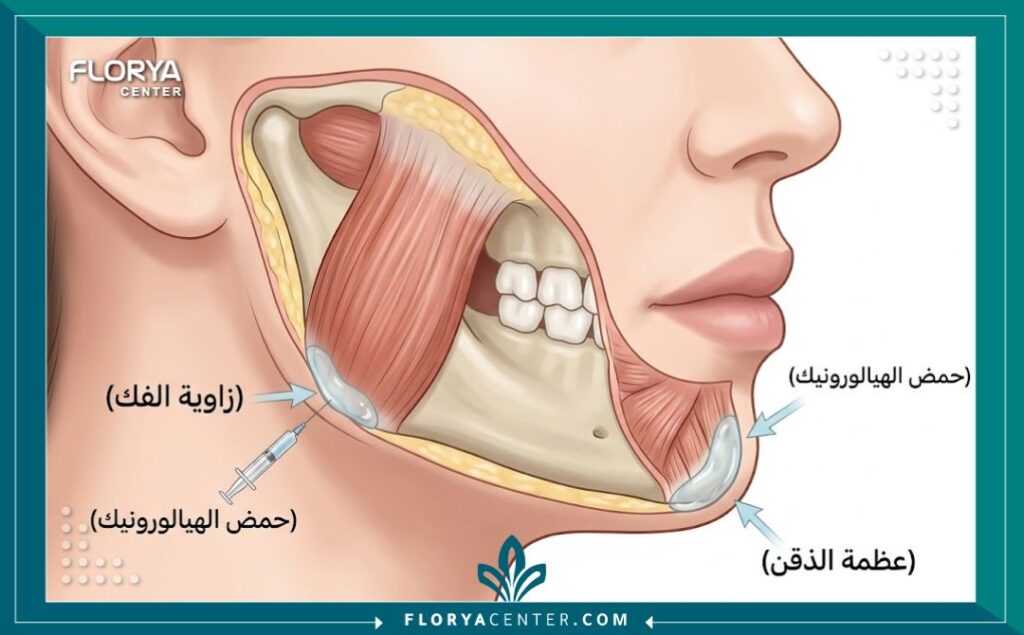 رسم تخطيطي طبي يوضح تشريح الوجه ومناطق حقن الفيلر لتحديد الفك ونحت الذقن.