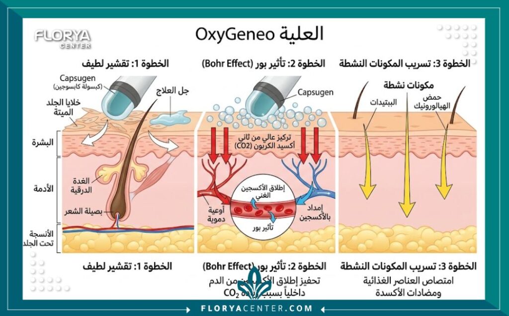 رسم توضيحي طبي يوضح مراحل تقنية الأكسجينيو للوجه: التقشير، تأثير بور لإطلاق الأكسجين داخليًا، وضخ المكونات المغذية للبشرة للحصول على نضارة وتفتيح في تركيا.