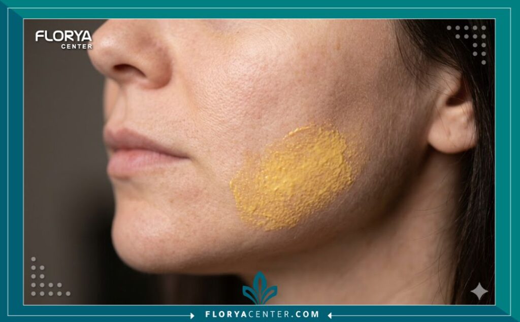 لقطة مكبرة توضح تطبيق مادة التقشير الأصفر على بشرة الوجه لعلاج البقع الداكنة وتحسين ملمس الجلد.