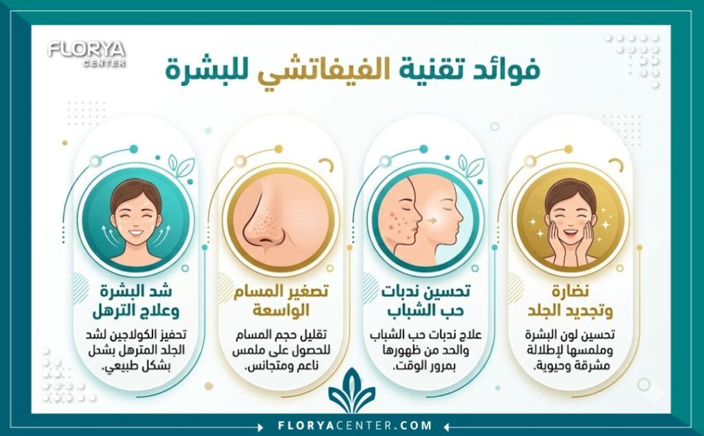 إنفوجرافيك يوضح أهم 4 فوائد لتقنية الفيفاتشي في تركيا تشمل شد البشرة، تصغير المسام، علاج الندبات، وزيادة النضارة.