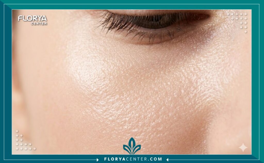 لقطة مكبرة تظهر جودة ونعومة الجلد تحت العين بعد الاستفادة من الخلايا الجذعية في تقنية النانو دهون لتجديد البشرة.