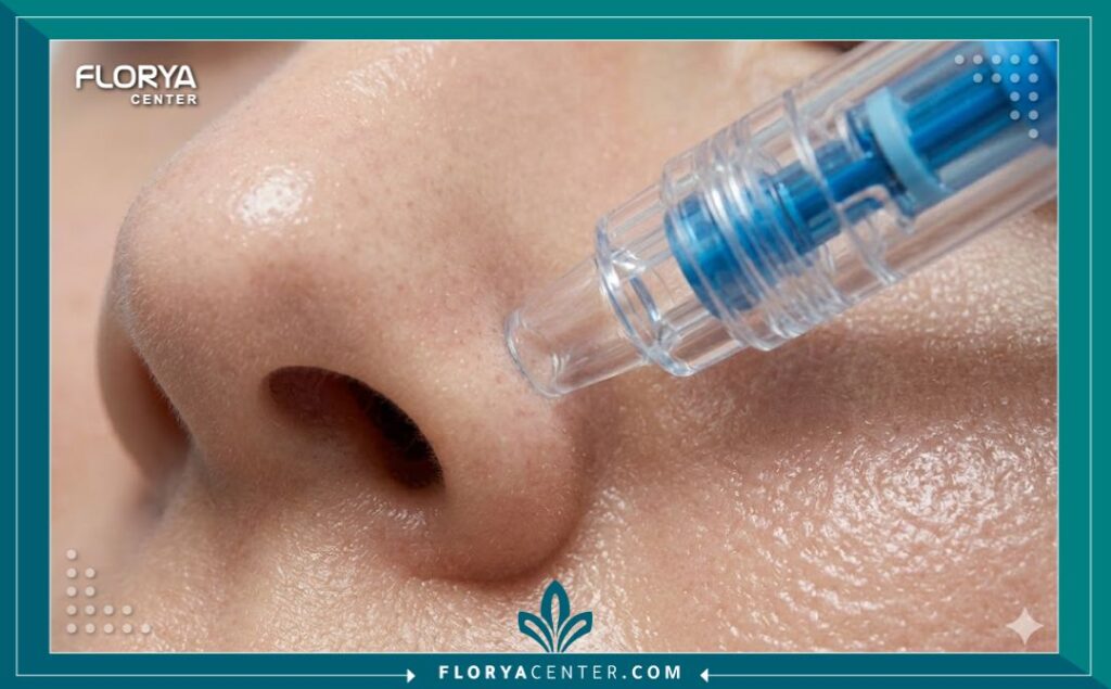 لقطة قريبة (Macro) تظهر تأثير جهاز الهيدرافيشل في شفط الرؤوس السوداء والزوان من الأنف وتنظيف المسام بعمق.