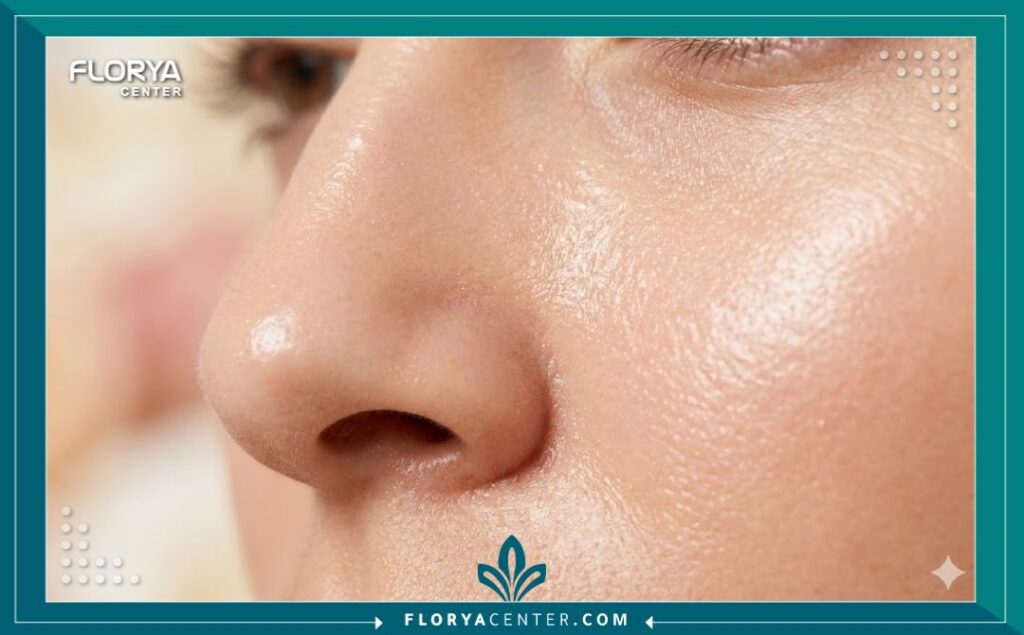 لقطة مقربة تظهر نتائج تفريغ المسام بالهيدرافيشل بشرة نقية وخالية من الزوان والرؤوس السوداء تمامًا.