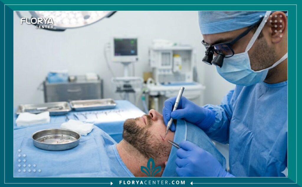 طبيب مختص يقوم بإجراء عملية زراعة دقيقة لتكثيف شعر اللحية باستخدام أحدث التقنيات في عيادة معقمة.