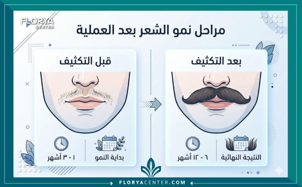 إنفوجرافيك يوضح مقارنة قبل وبعد تكثيف شعر الشارب وعلامات نمو الشعر