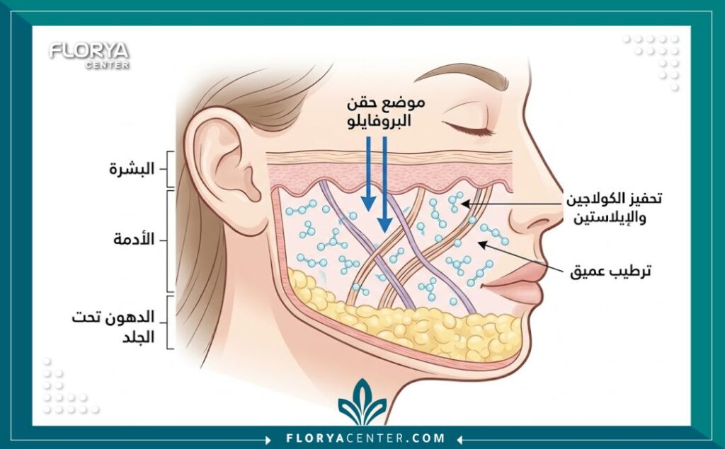 رسم بياني طبي تشريحي يوضح طبقات الجلد وموضع حقن إبرة البروفايلو في الأدمة لتحفيز الكولاجين والإيلاستين وتحقيق الترطيب العميق للوجه.