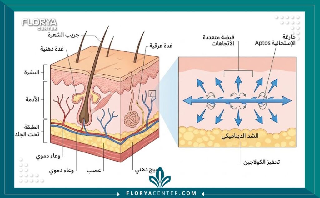 رسم توضيحي طبي يُظهر آلية عمل خيوط الأبتوس ثنائية الاتجاه تحت الجلد لتحفيز الكولاجين.