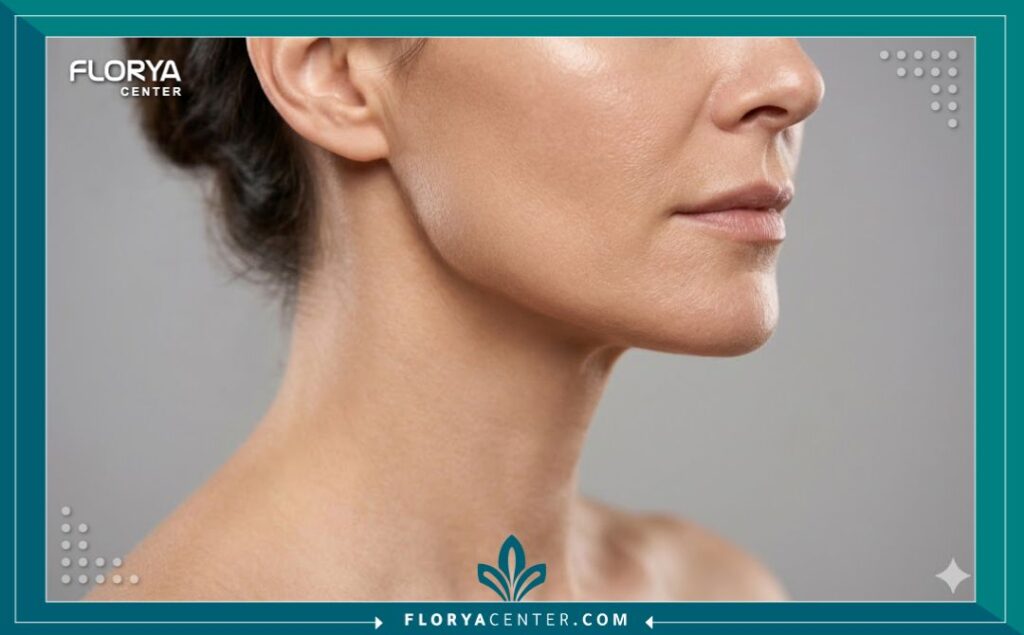 لقطة قريبة جانبية تبرز تحديد الفك المرفوع ونعومة الرقبة بعد تطبيق تقنية خيوط الشد العمودي للتخلص من الترهل.