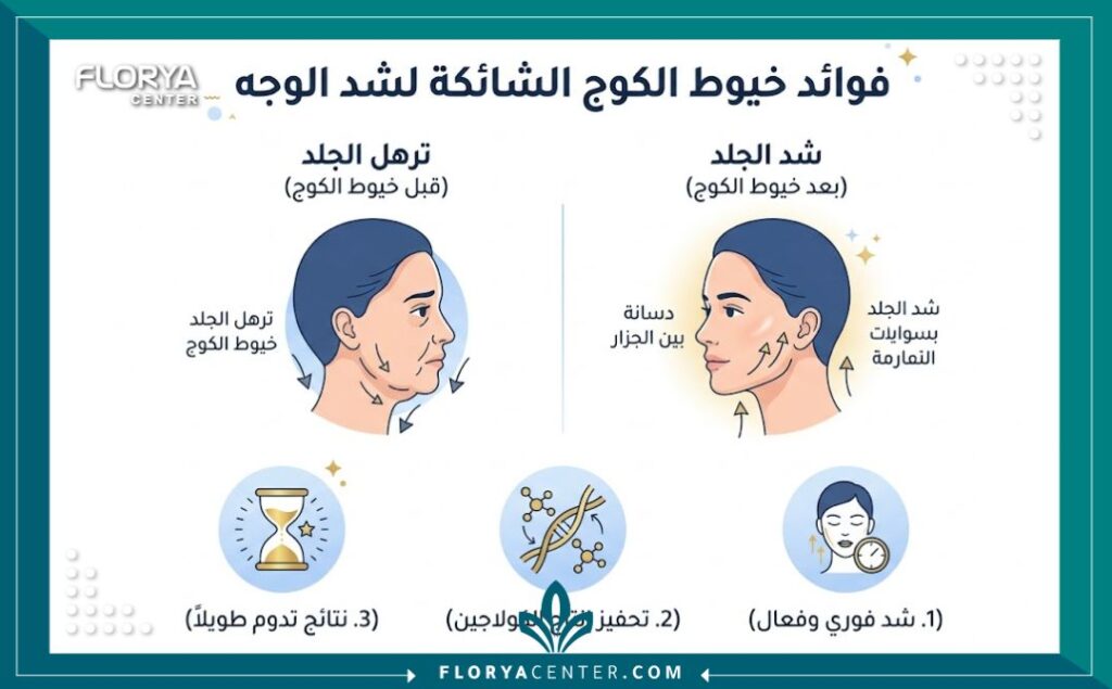 إنفوجرافيك يوضح مقارنة بين شكل الجلد قبل وبعد استخدام خيوط الكوج الشائكة لشد الوجه، مع أبرز الفوائد مثل تحفيز الكولاجين والشد الفوري.