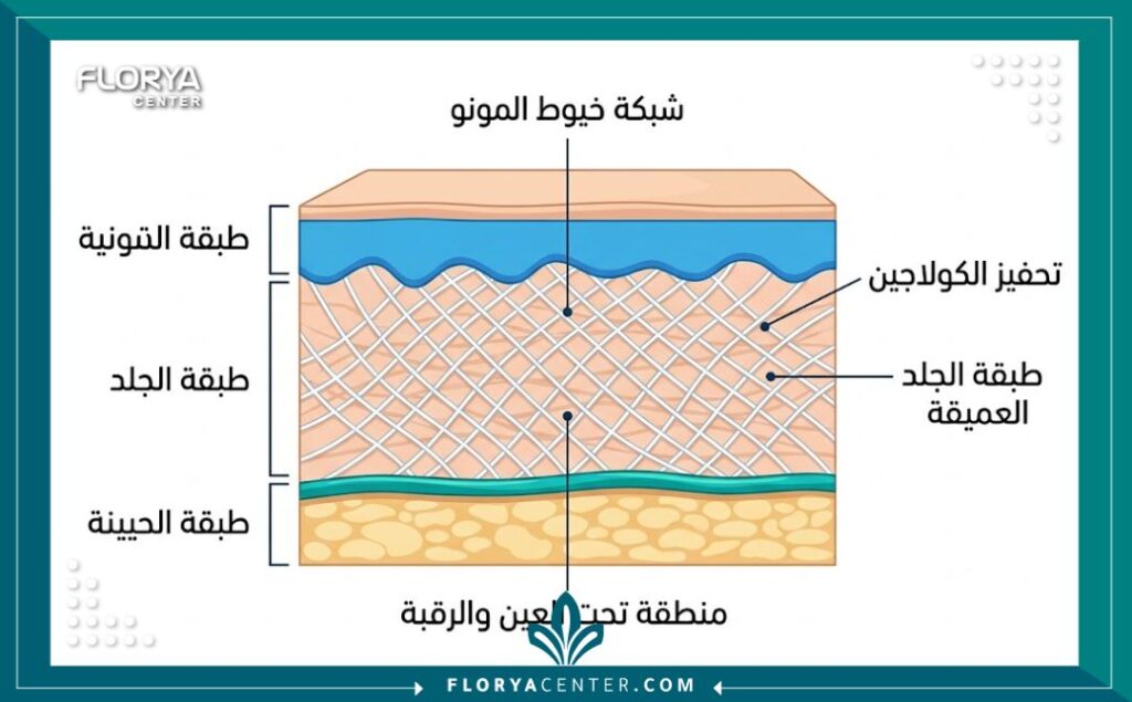 رسم تخطيطي طبي يوضح كيفية عمل شبكة من خيوط المونو الملساء في تحفيز الكولاجين داخل طبقات الجلد في منطقة تحت العين والرقبة.