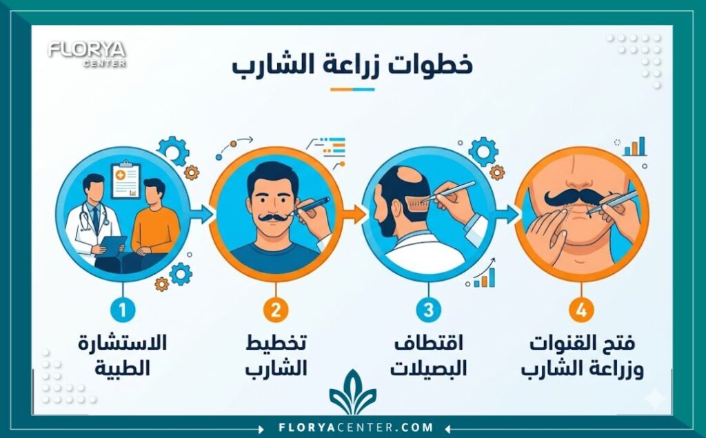 إنفوجرافيك يوضح خطوات زراعة الشارب الأربعة: الاستشارة، تخطيط الشارب، اقتطاف البصيلات، وفتح القنوات وزراعتها.