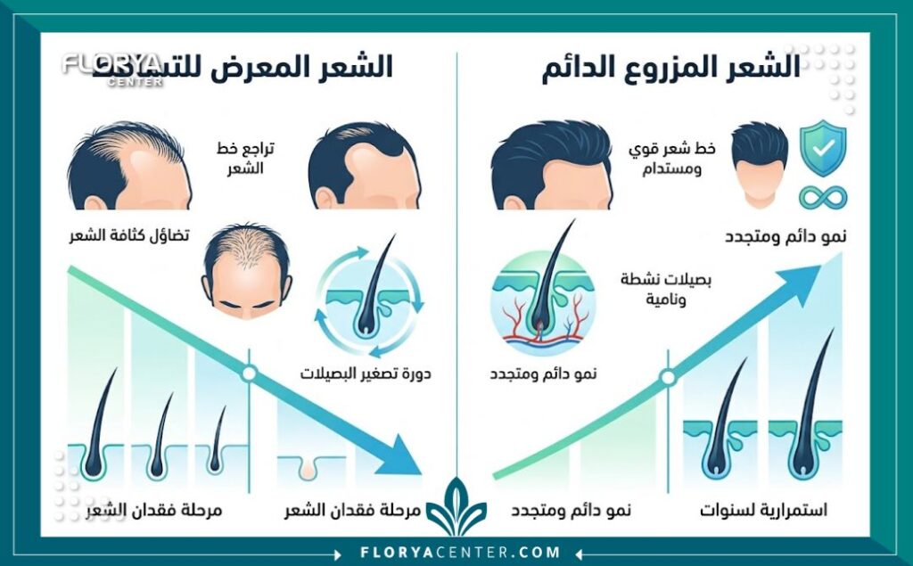 رسم بياني زراعة الشعر الطبيعي و الدائم للمقارنة: كيف يحافظ الشعر المزروع على كثافته الدائمة مقارنة بالشعر المعرض للتساقط.
