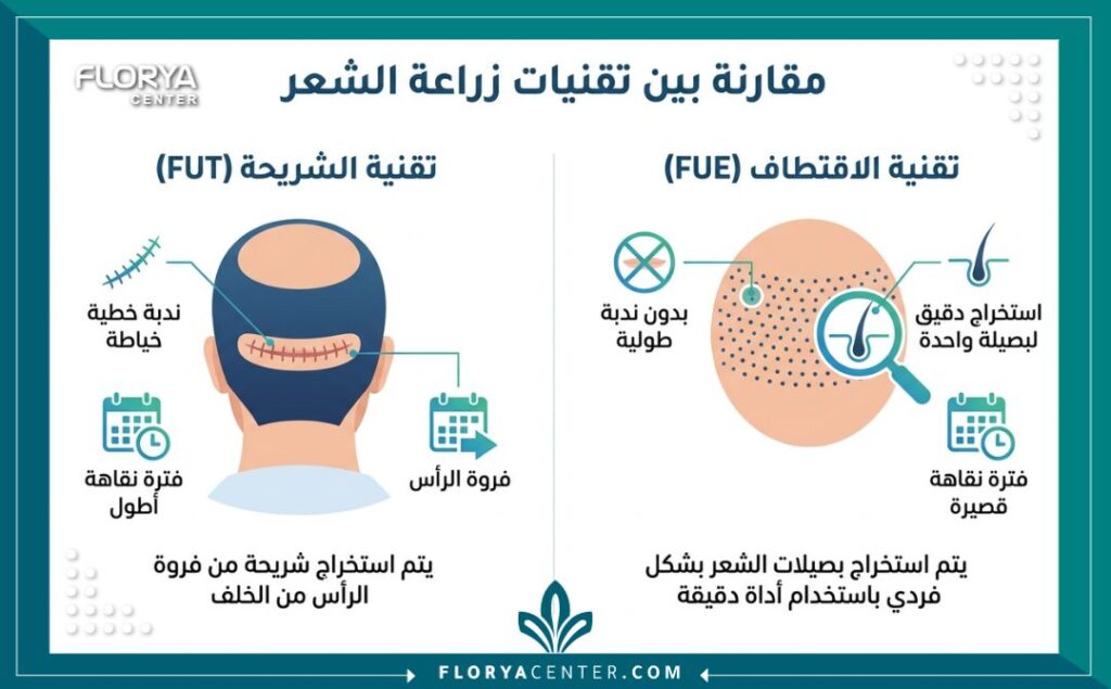إنفوجرافيك للمقارنة بين زراعة الشعر بالاقتطاف FUE وزراعة الشعر بالشريحة FUT يوضح المزايا والفرق في الندبات ووقت التعافي.