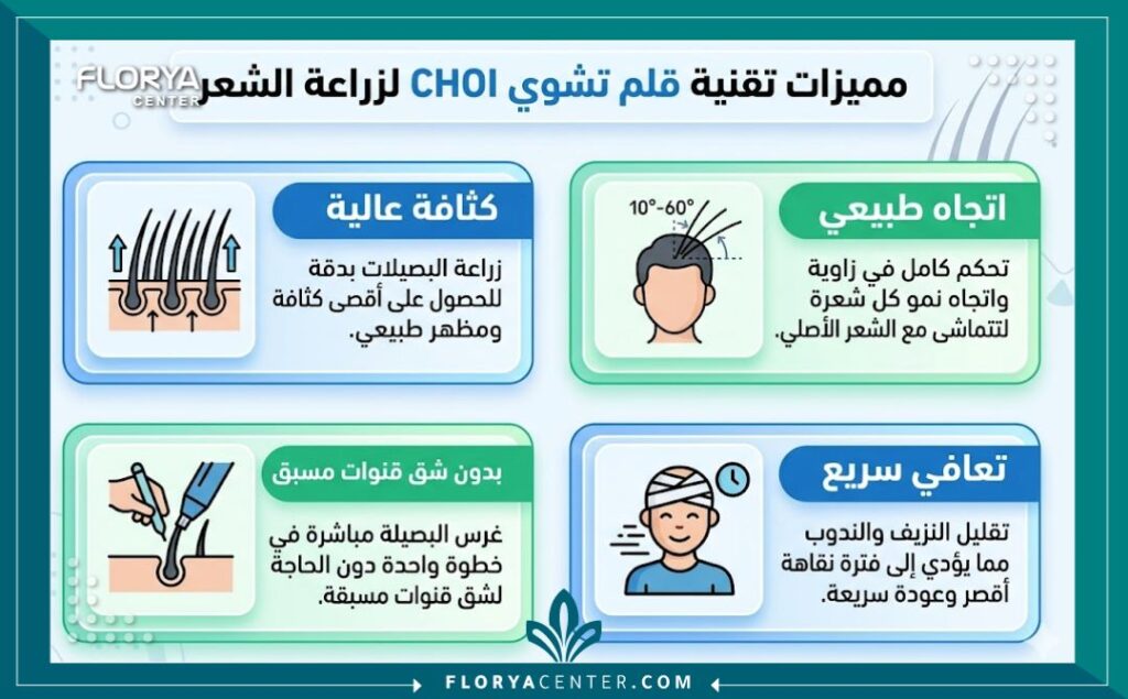 انفوجرافيك يوضح أبرز مزايا زراعة الشعر بالقلم تشوي CHOI، وتشمل الكثافة العالية، المظهر الطبيعي، وعدم الحاجة لفتح قنوات مسبقة.