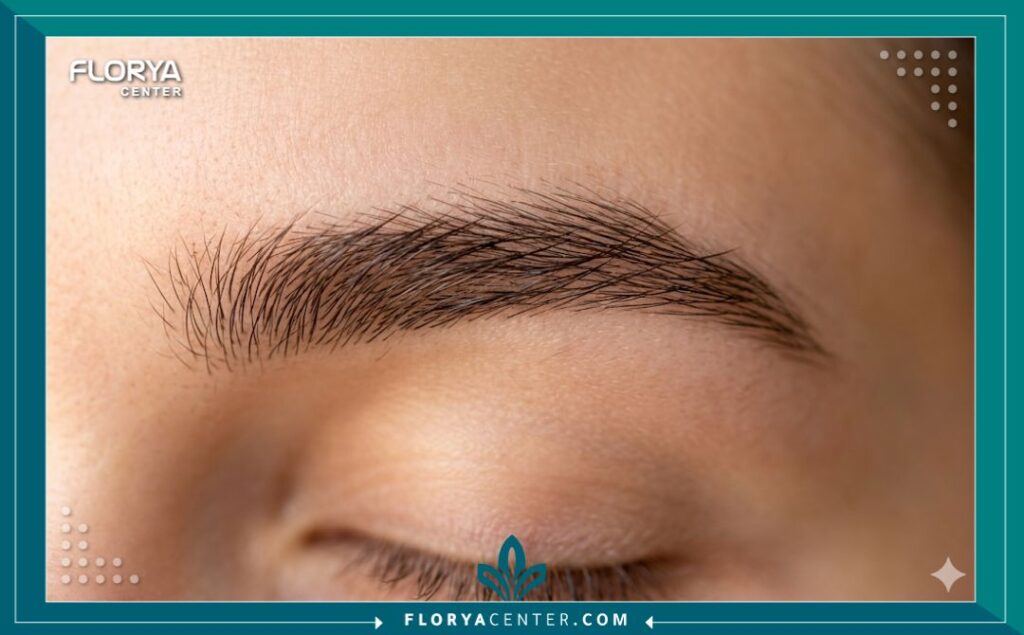 لقطة مكبرة تظهر تفاصيل وكثافة واتجاه نمو الشعر الطبيعي بعد نجاح زراعة الحواجب.