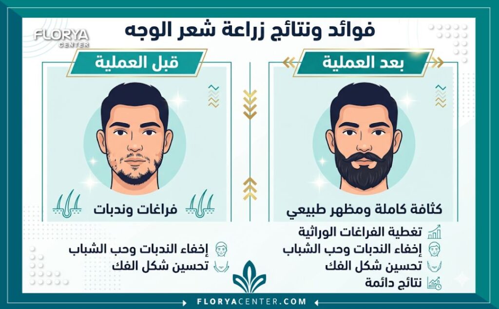 إنفوجرافيك يوضح مقارنة بين قبل وبعد زراعة شعر الوجه، ويبرز فوائد زراعة اللحية في تغطية الفراغات والندبات وتحقيق الكثافة.
