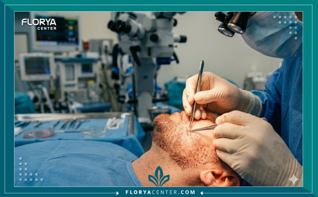 جراح متخصص في زراعة الشعر يقوم بدقة بزراعة بصيلات الشعر في منطقة اللحية للمريض داخل غرفة عمليات معقمة وحديثة في عيادة تجميل.