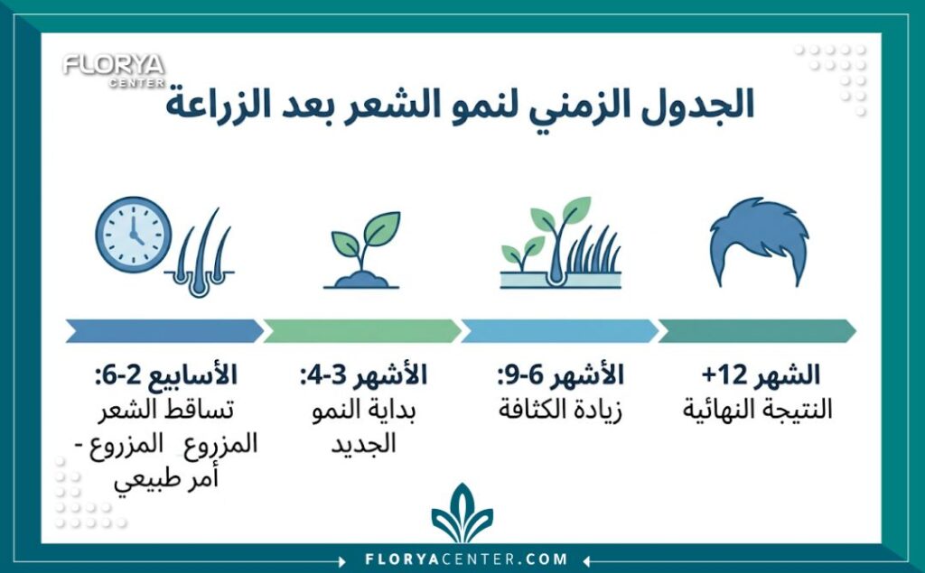 إنفوجرافيك يوضح الجدول الزمني لنمو الشعر بعد الزراعة، يبين أن تساقط الشعر المزروع في الأسابيع الأولى هو مرحلة مؤقتة وطبيعية.