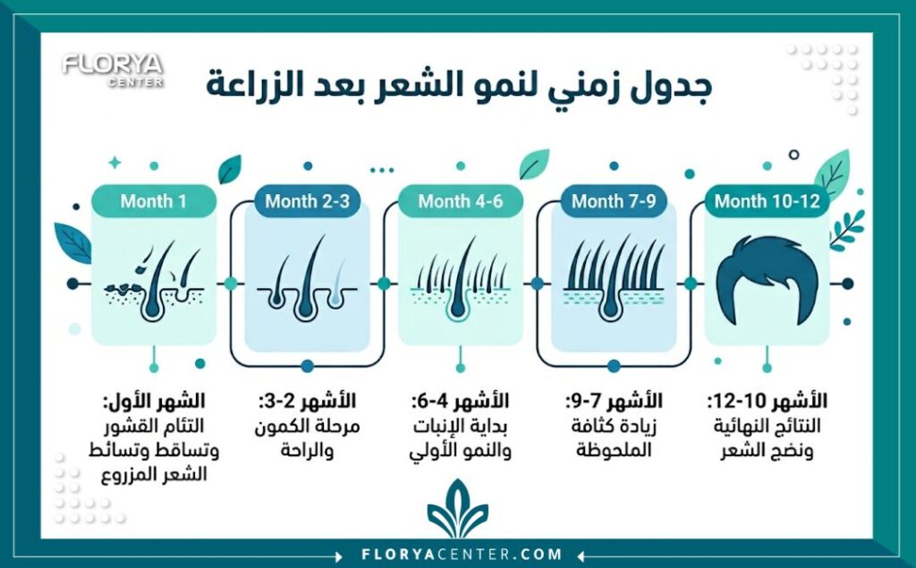 انفوجرافيك يوضح جدول زمني لمراحل صور بعد زراعة الشعر شهراً بشهر بالتفصيل