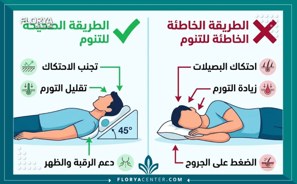 مخطط بياني للمقارنة بين الطريقة الصحيحة والخاطئة طريقة النوم بعد عملية زراعة الشعر، مع توضيحات باللغة العربية.