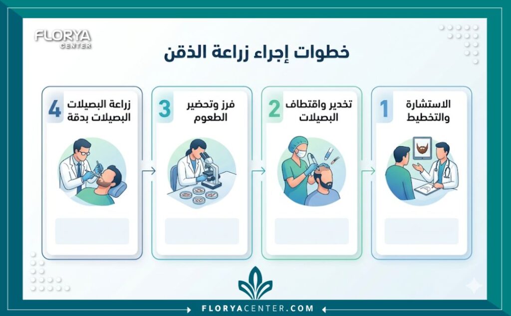 إنفوجرافيكيوضح خطوات طريقة زراعة شعر الذقن بالتفصيل من الاستشارة حتى الزرع النهائي.