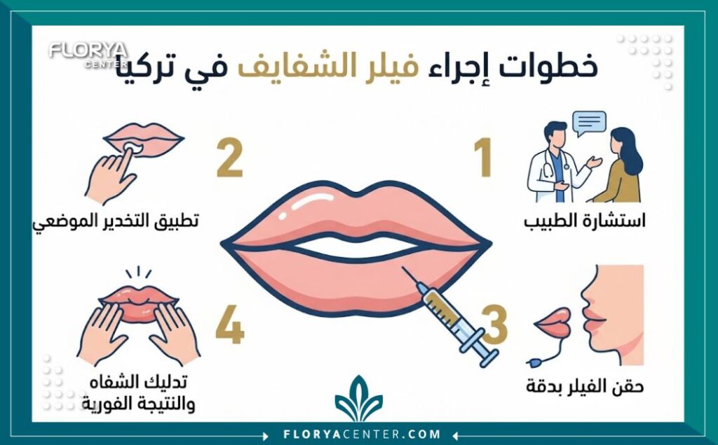 انفوجرافيك يوضح خطوات عملية حقن فيلر الشفايف في مراكز التجميل التركية بالتفصيل