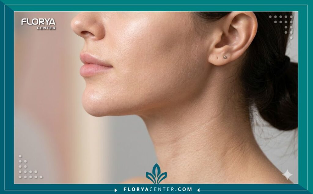 لقطة قريبة تظهر تحديد الفك والذقن (تقنية تكساس) بواسطة فيلر الوجه