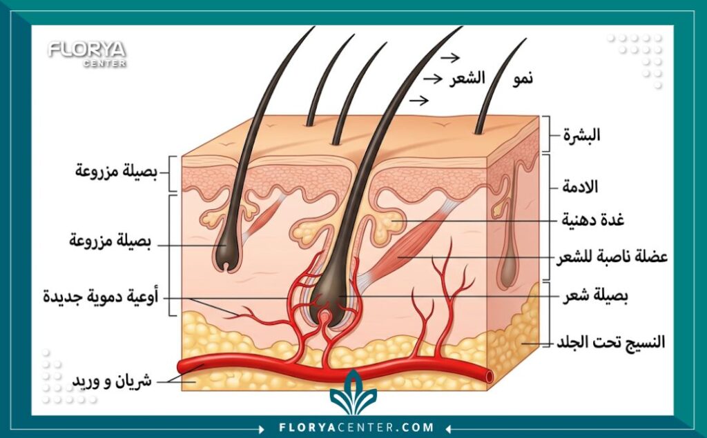 رسم تخطيطي طبي يوضح تشريح فروة الرأس ونجاح انغراس البصيلات بعد عملية زراعة الشعر.