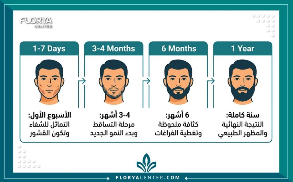 إنفوجرافيك يوضح الجدول الزمني لمراحل نمو الشعر بعد زراعة اللحية، من الأسبوع الأول حتى السنة الأولى.