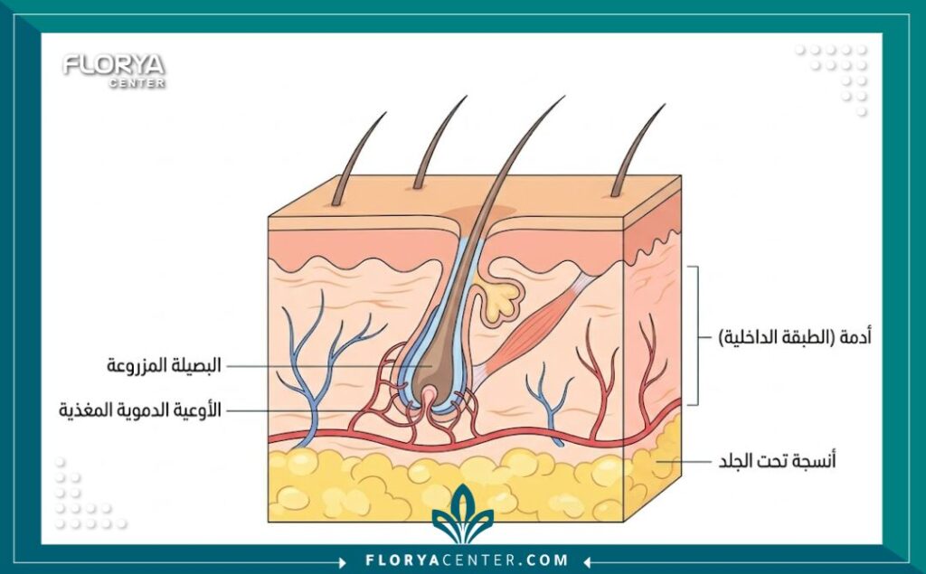 رسم توضيحي طبي يوضح تشريح فروة الرأس وكيفية استقرار بصيلة الشعر المزروعة حديثًا تحت الجلد.