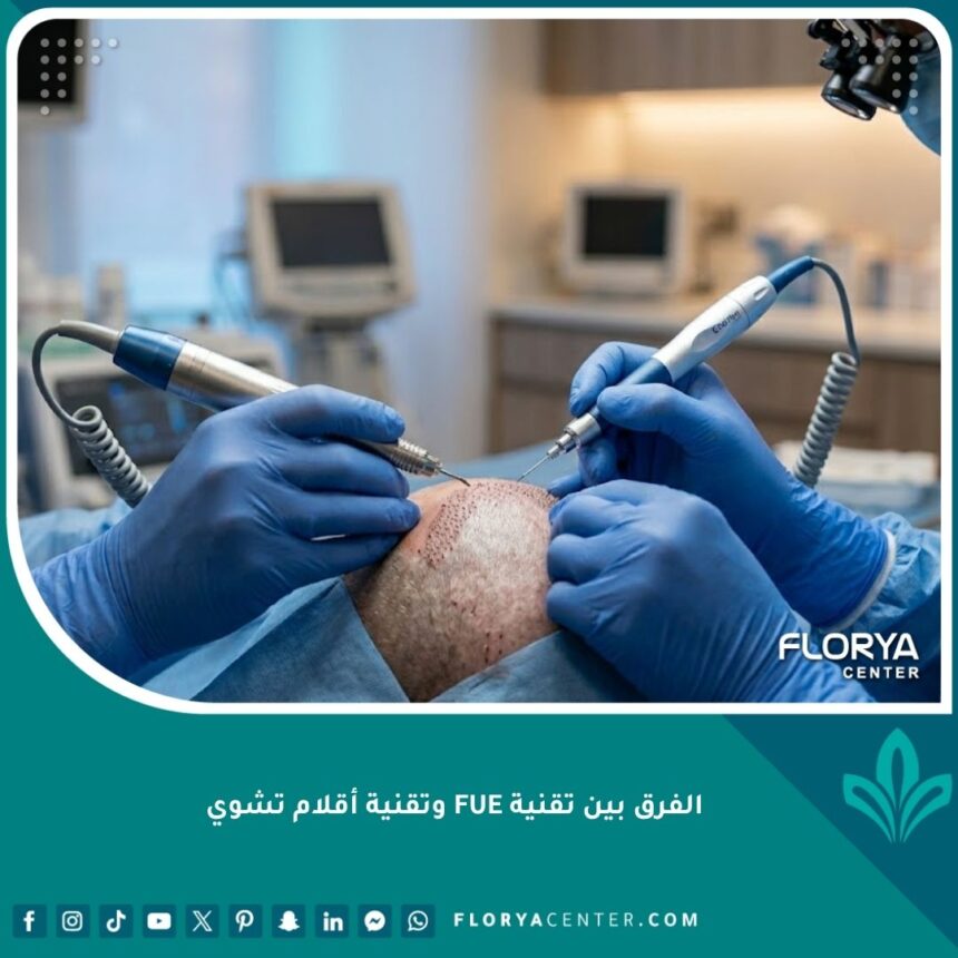 واجهة مقال توضح الفرق بين تقنية FUE وتقنية أقلام تشوي لزراعة الشعر بجودة احترافية.