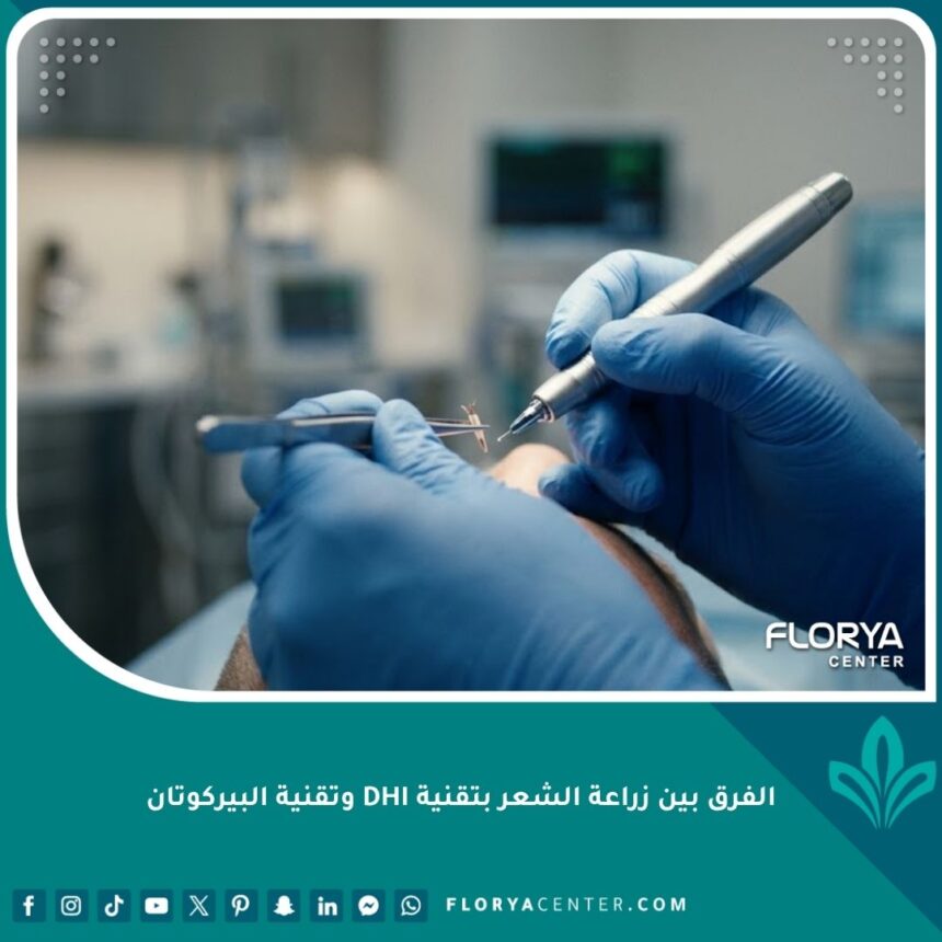 مقارنة احترافية بين تقنية زراعة الشعر DHI وتقنية البيركوتان الحديثة في تركيا.
