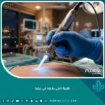 تقنية الجي بلازما (الرينوفيون) لشد الجلد المترهل في تركيا - لقطة مقربة سينمائية للجهاز.