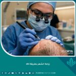 لقطة سينمائية قريبة لطبيب يستخدم قلم تشوي لزراعة بصيلات الشعر مباشرة في فروة الرأس بتقنية DHI