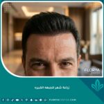 نتيجة طبيعية وناجحة لعملية زراعة شعر للجبهه الكبيره لرجل، تُظهر خط شعر أمامي منخفض وكثيف في عيادة تجميل راقية.