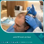 صورة بارزة احترافية توضح عملية حقن البلازما الغنية بالصفائح الدموية (PRP) في فروة الرأس لتقوية البصيلات.